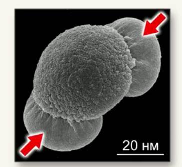 Рас­по­ло­же­ние пу­зырь­ков в обо­лоч­ке муж­ско­го га­ме­то­фи­та под элек­трон­ным мик­ро­ско­пом