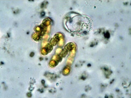 Ци­анобак­те­рии
