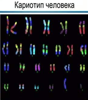 Ка­ри­о­тип че­ло­ве­ка – муж­чи­ны (в пра­вом ниж­нем углу хро­мо­со­мы ХУ) – фо­то­гра­фии ана­фаз­ных хро­мо­сом