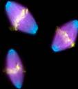 Ме­та­фа­за. Окра­шен­ный пре­па­рат. Ве­ре­те­но де­ле­ния об­ра­зо­ван­но цен­тро­ме­ра­ми (го­лу­бые), мик­ро­фиб­рил­ла­ми (фи­о­ле­то­вые) и хро­мо­со­ма­ми ме­та­фаз­ной пла­стин­ки – жел­тые.