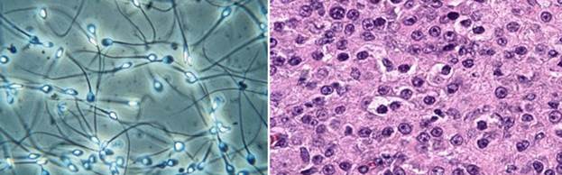 Спер­ма­то­зо­и­ды и ин­тер­сти­ци­аль­ные (лей­ди­го­вые) клет­ки